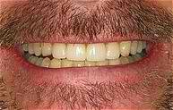 Smile With A Beard