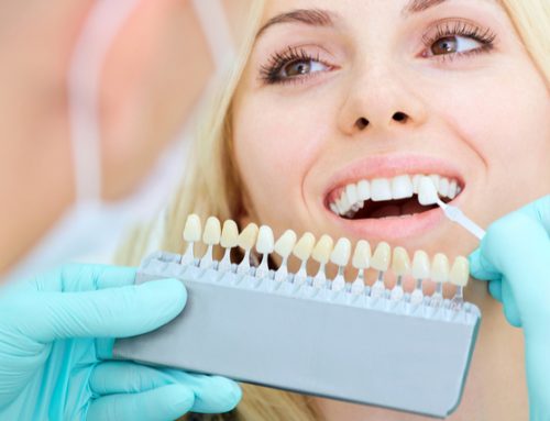 Get Teeth Cleaning Now: Avoid Trouble Later