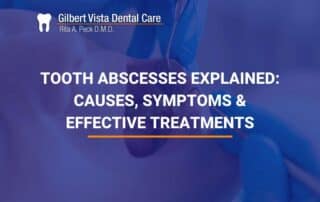 Tooth Abscesses Explained