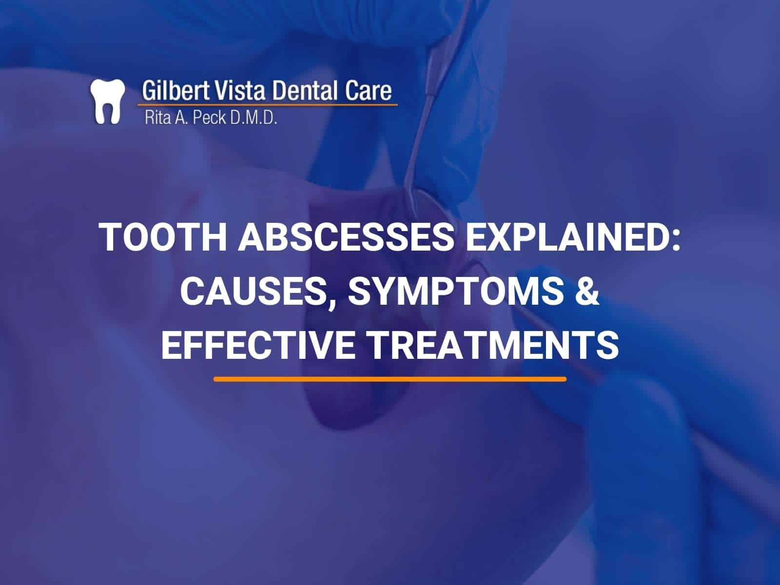 Tooth Abscesses Explained