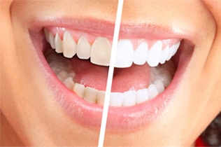 Cosmetic Dentistry Dental Services In Gilbert