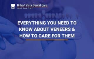 Everything You Need To Know About Veneers & How To Care For Them