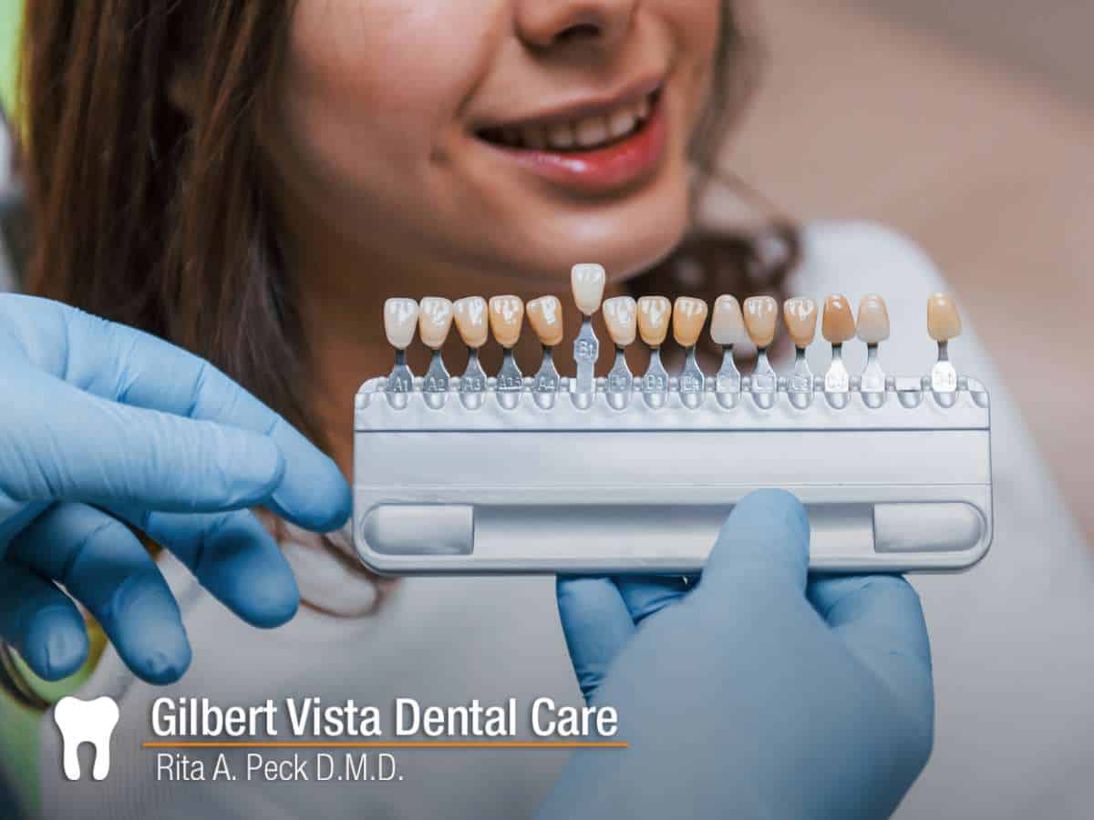 Selecting veneers for a natural-looking smile at Gilbert Vista Dental Care