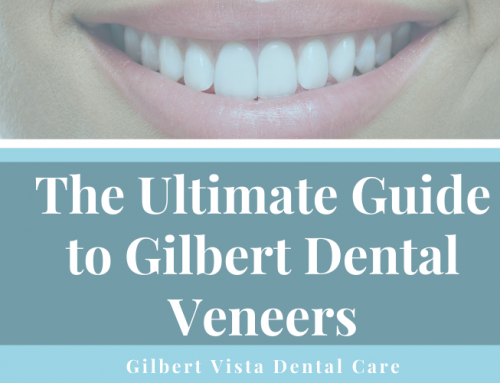 The Ultimate Guide to Gilbert Dental Veneers