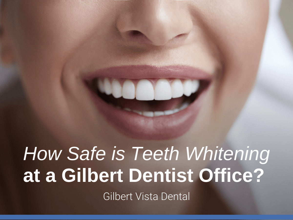 How Safe is Teeth Whitening at a Gilbert Dentist Office? - Gilbert Vista  Dental