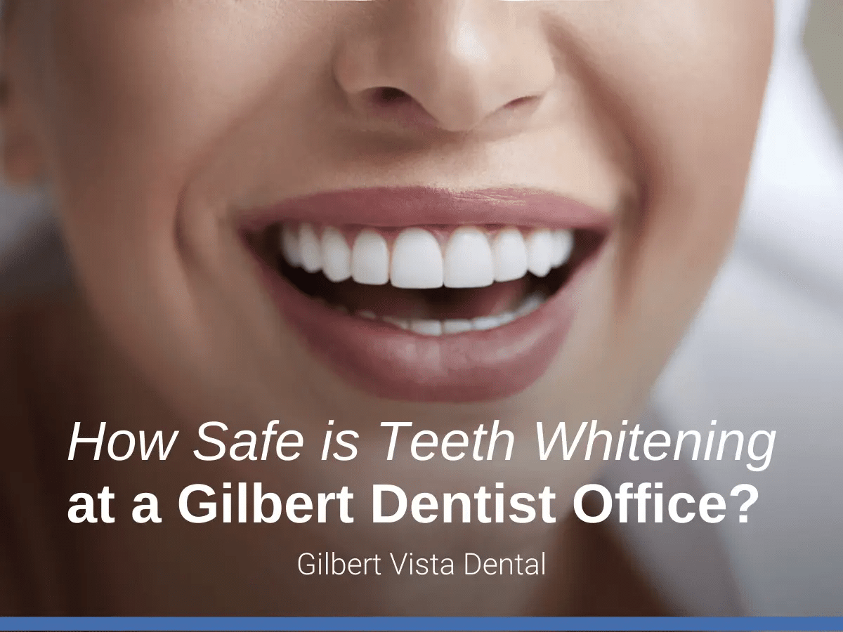 How Safe is Teeth Whitening at a Gilbert Dentist Office?