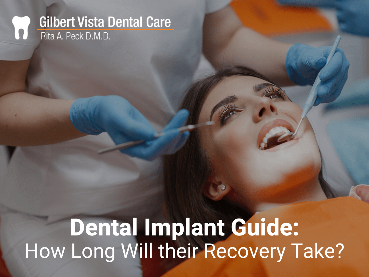 Dental Implant Guide: How Long Will their Recovery Take?