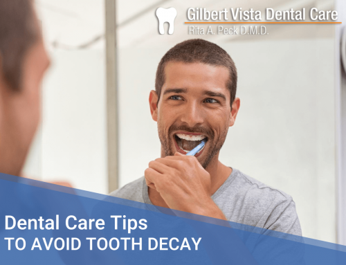 Dental Care Tips to Avoid Tooth Decay