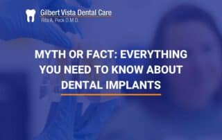 Myth Or Fact: Everything You Need To Know About Dental Implants