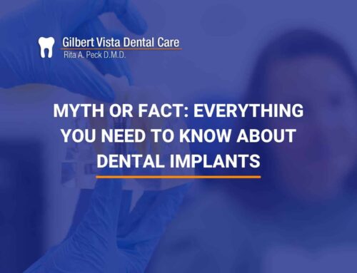 Myth Or Fact: Everything You Need To Know About Dental Implants