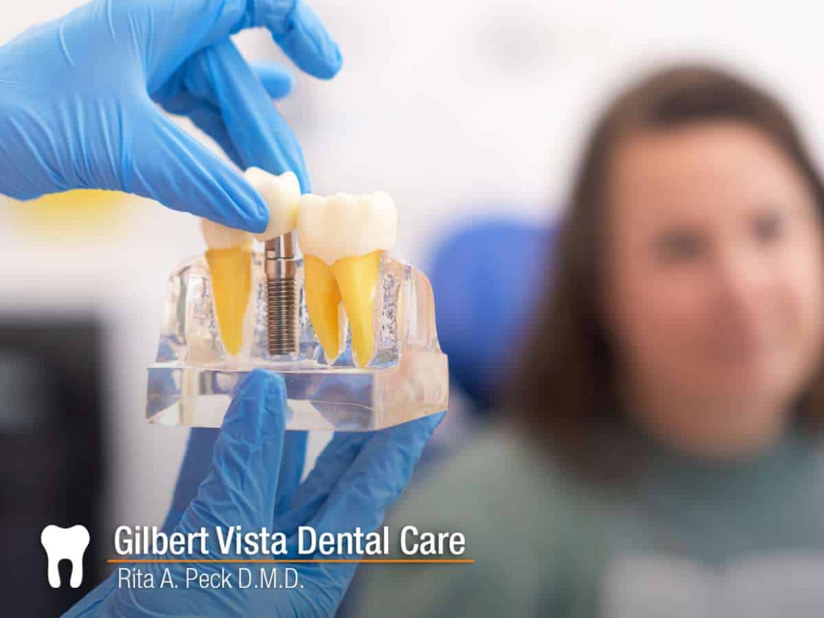 Close-up of a dentist showing a dental implant to a patient