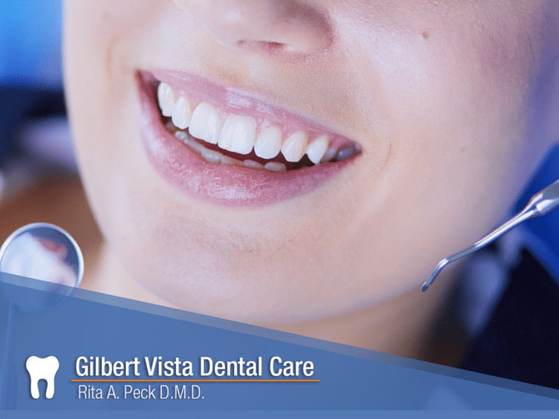 Myth or Fact, The Truth About Gilbert Dental Implants Gilbert Vista