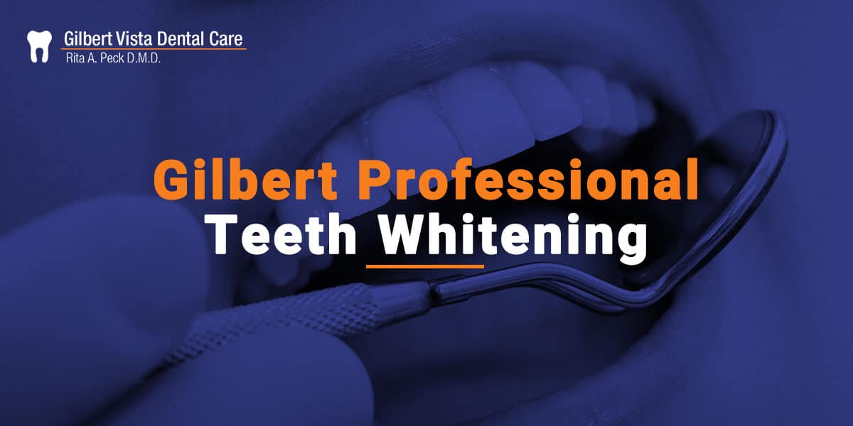Professional Teeth Whitening Services In Gilbert, AZ