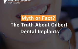 Myth or Fact? The Truth About Gilbert Dental Implants