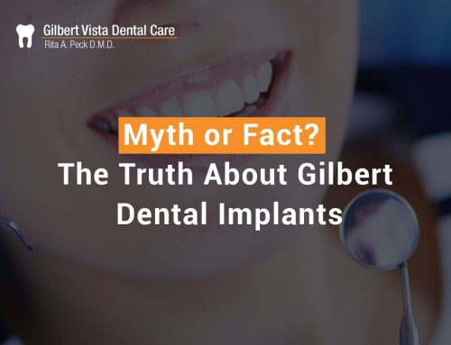 Myth or Fact, The Truth About Gilbert Dental Implants