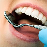 Safe & Protective Fillings For Your Teeth In Gilbert