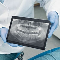 Accurate & High Quality Dental Images