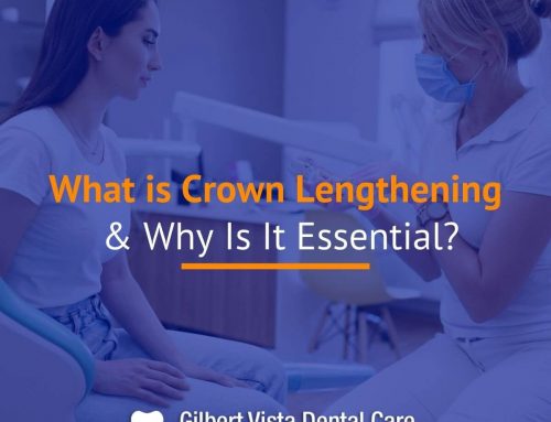 What is Crown Lengthening & Why Is It Essential?