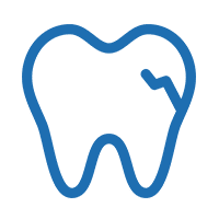 Porcelain Dental Veneers Repair Broken Tooth