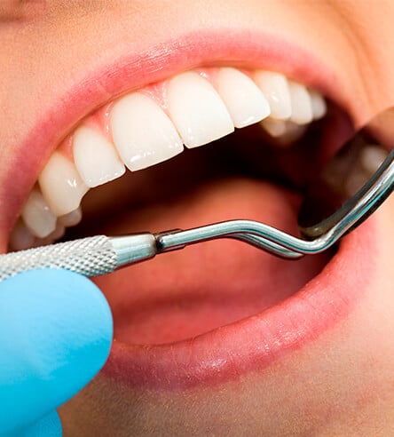 Affordable Dentists & Teeth Sealants Near You