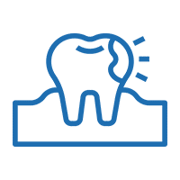 Deal With Broken Or Chipped Teeth With Zirconia Crowns In Gilbert