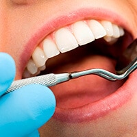 How Long Do Dentures Last?