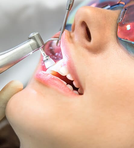Affordable Gilbert Dentists & Teeth Cleaning Near You