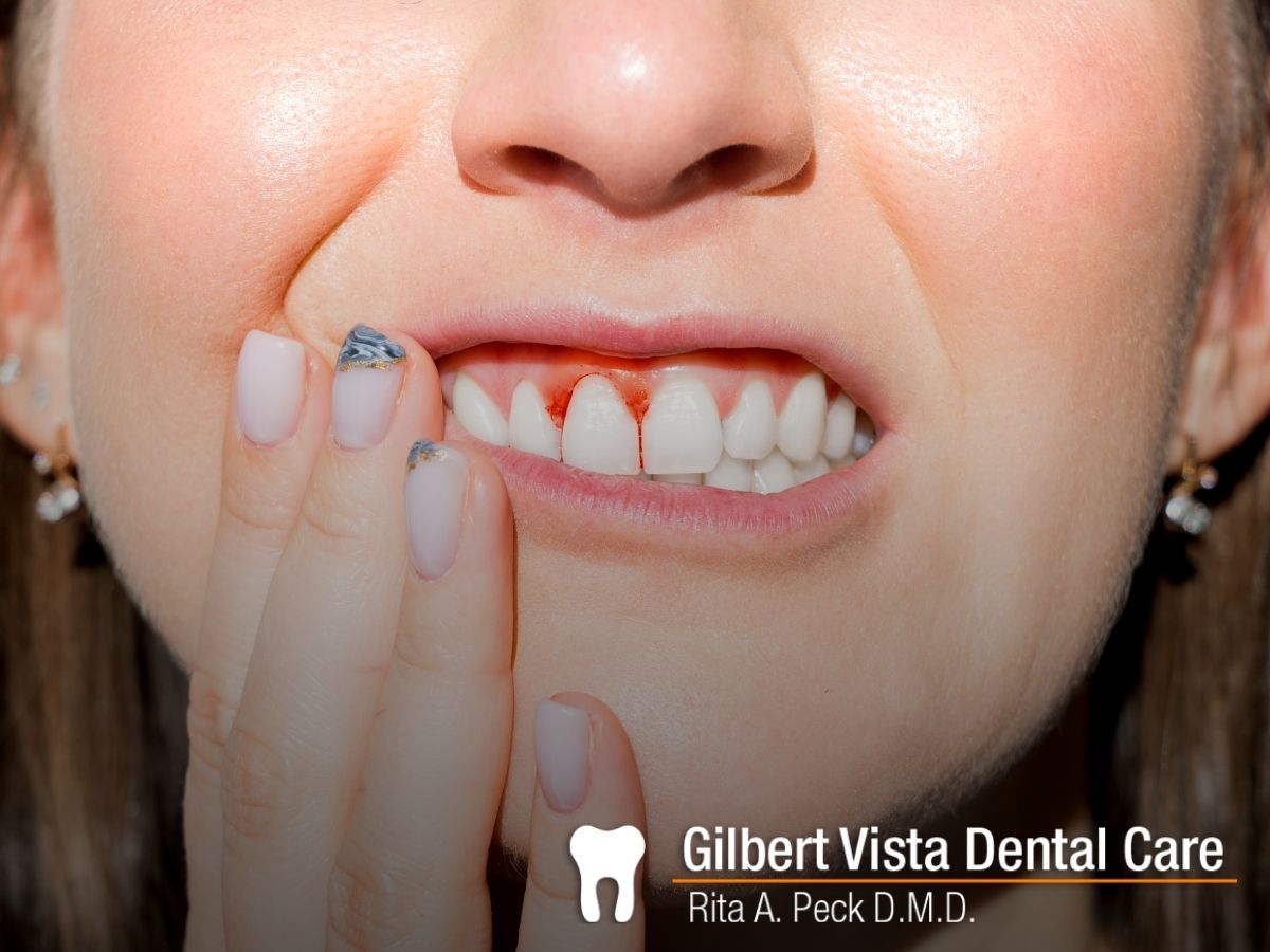 Woman with Gum Disease in Gilbert, AZ