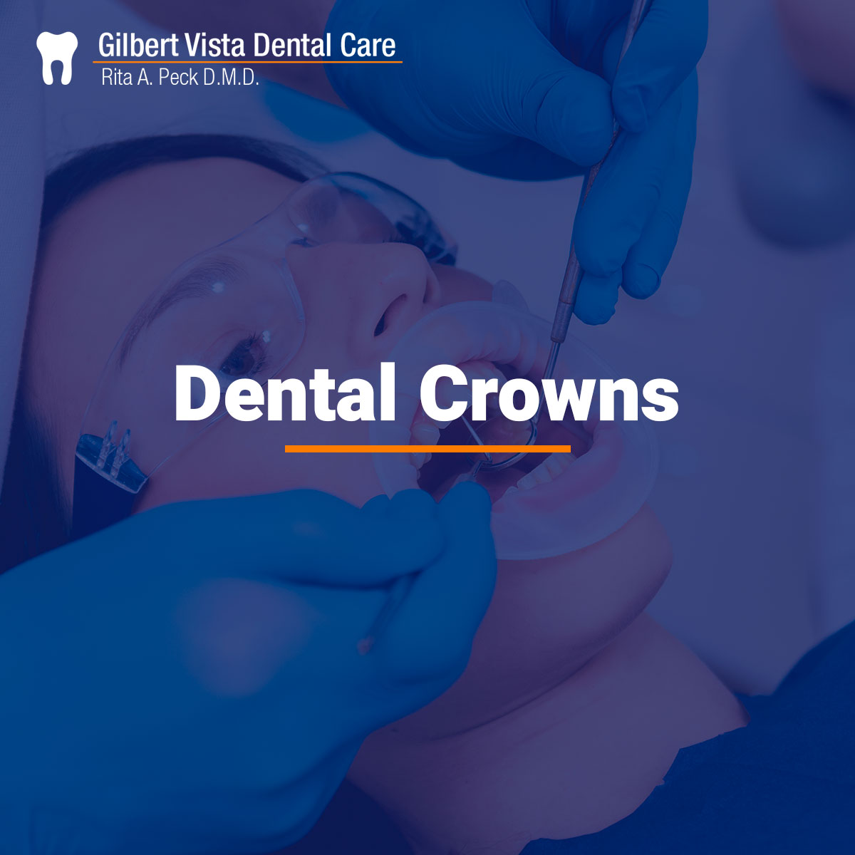 Affordable Tooth Crowns In Gilbert | Gilbert Vista Dental