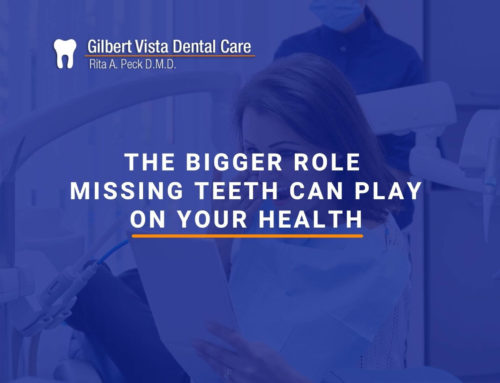 The Bigger Role Missing Teeth Can Play On Your Health