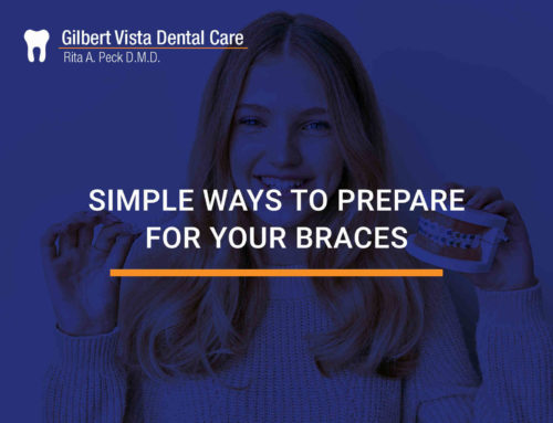Simple Ways To Prepare For Your Braces