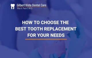 How To Choose The Best Tooth Replacement For Your Needs