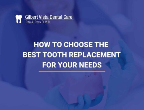 How To Choose The Best Tooth Replacement For Your Needs