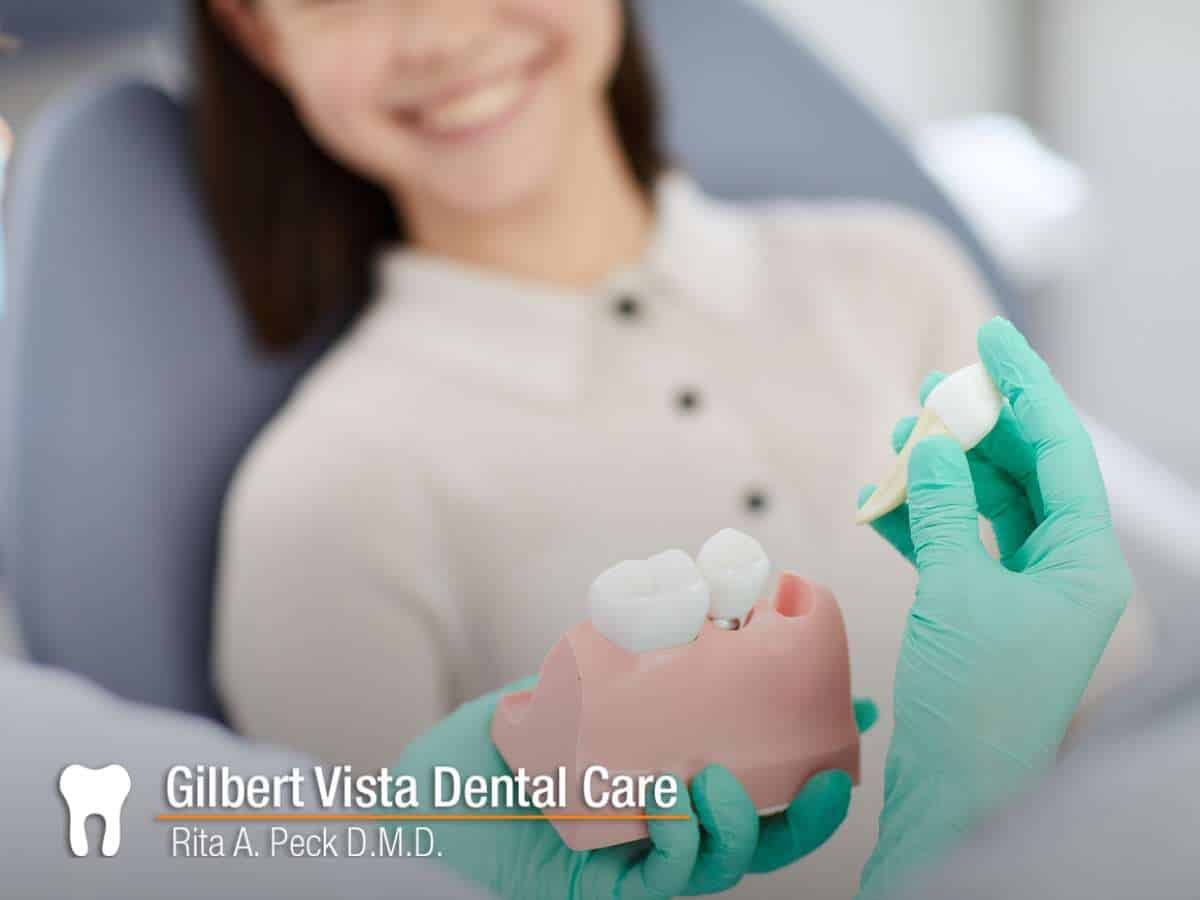 Dentist explaining Tooth Replacement options with dental model