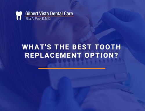 What’s The Best Tooth Replacement Option?