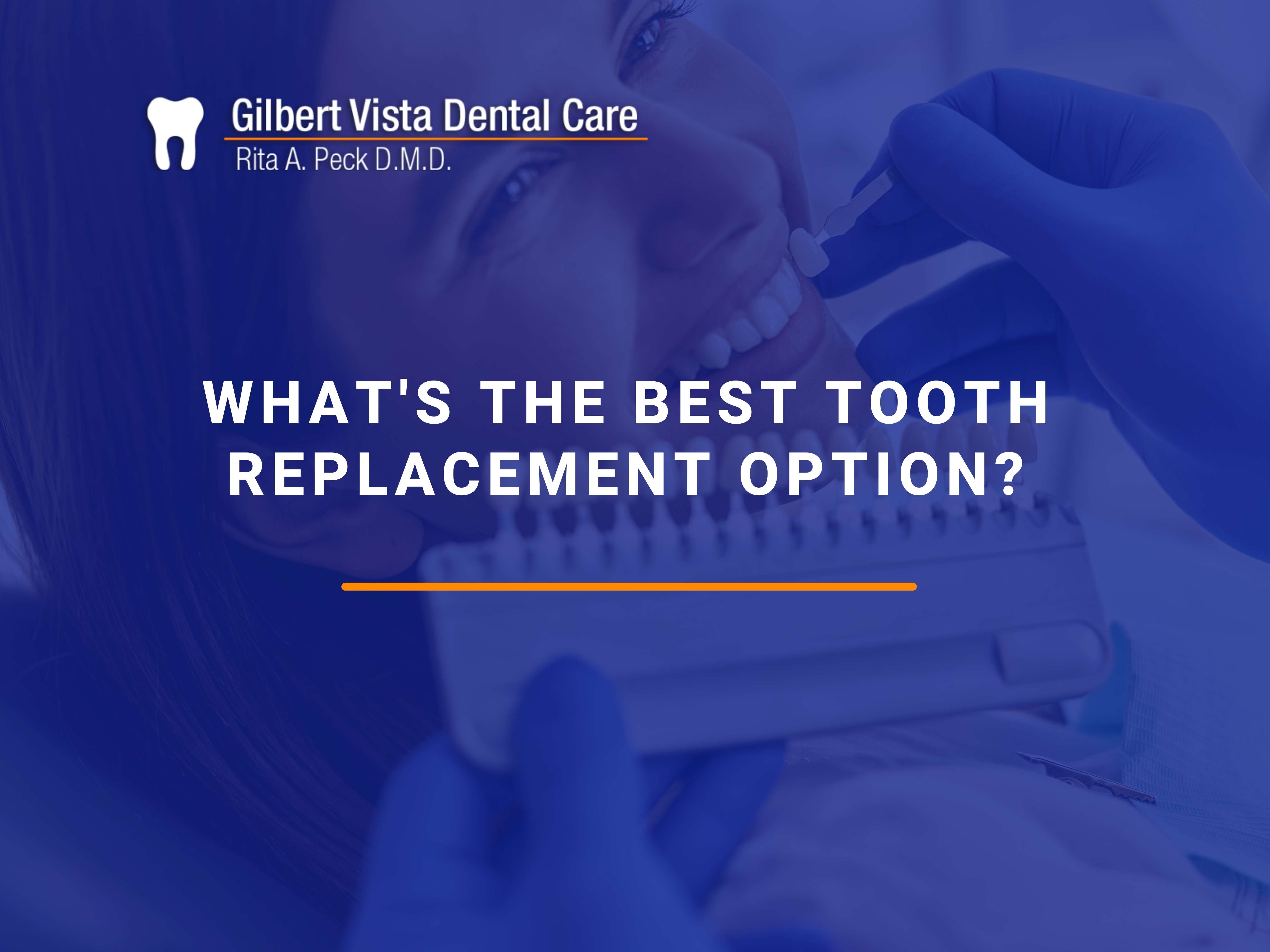 Whats The Best Tooth Replacement Option