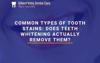 Common Types Of Tooth Stains: Does Teeth Whitening Actually Remove Them?