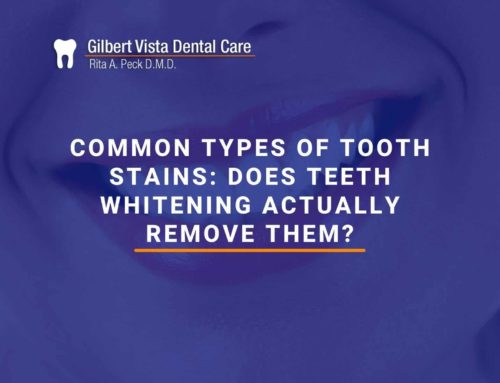Common Types Of Tooth Stains: Does Teeth Whitening Actually Remove Them?