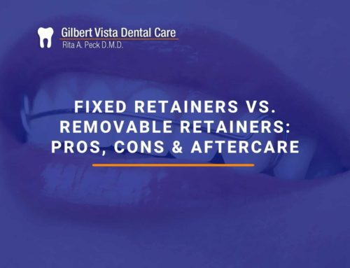 Fixed Retainers Vs. Removable Retainers: Pros, Cons & Aftercare