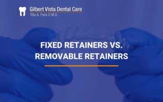Fixed Retainers vs. Removable Retainers
