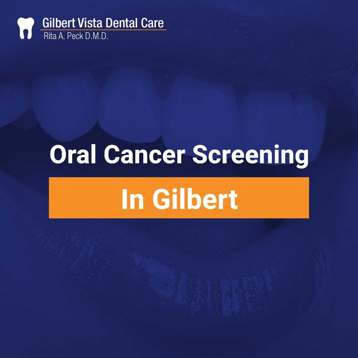 Oral Cancer Screening Gilbert Dentist Oral Cancer Oral Cancer Screening Gilbert Dentist Oral Cancer