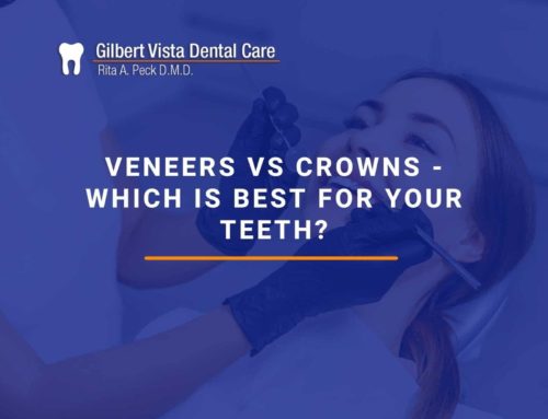 Veneers Vs Crowns – Which Is Best For Your Teeth?