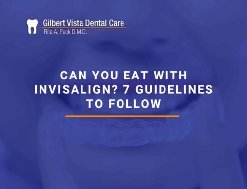 Can You Eat With Invisalign? 7 Guidelines To Follow