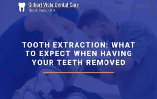 What To Expect When Having Your Teeth Removed