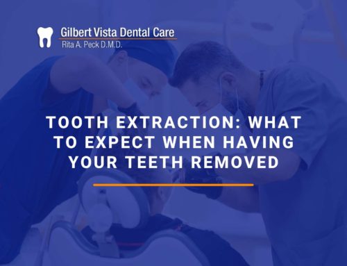 Tooth Extraction: What To Expect When Having Your Teeth Removed