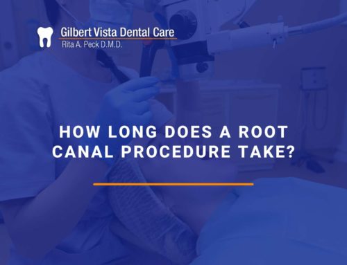 How Long Does A Root Canal Procedure Take?
