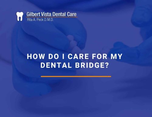 How Do I Care For My Dental Bridge?