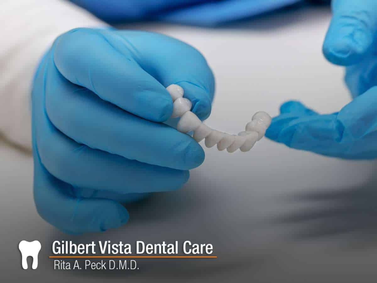 Dental Bridge Care in Gilbert, AZ