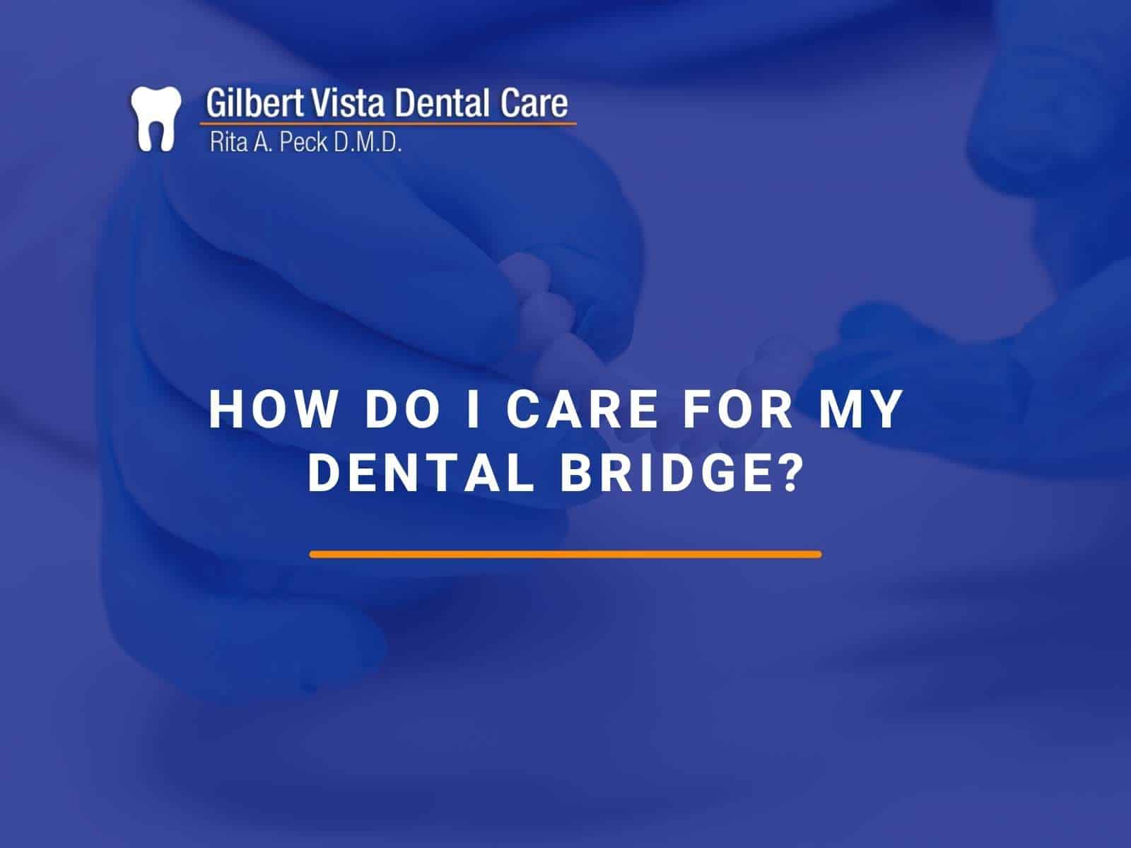 How Do I Care For My Dental Bridge