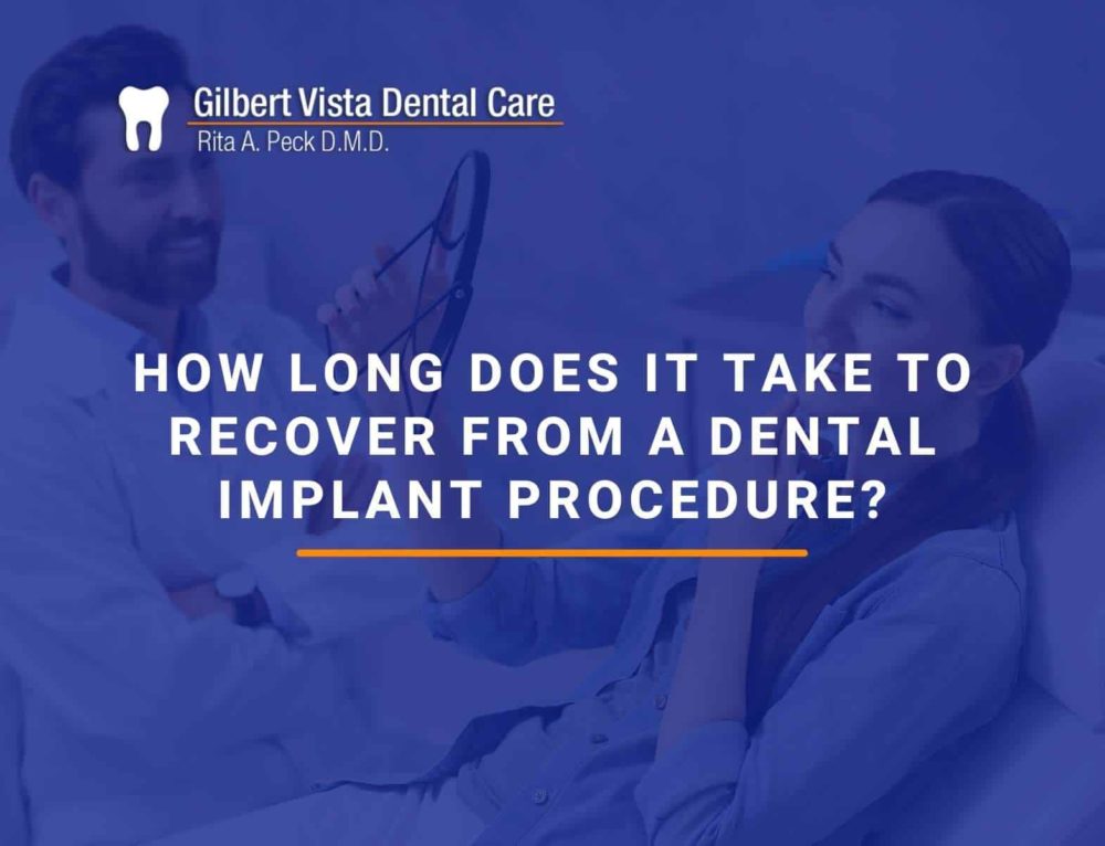 What Is The Recovery Time For a Dental Implant Procedure?